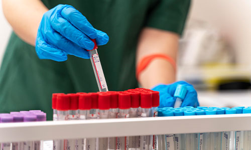 Core Blood Work Panel